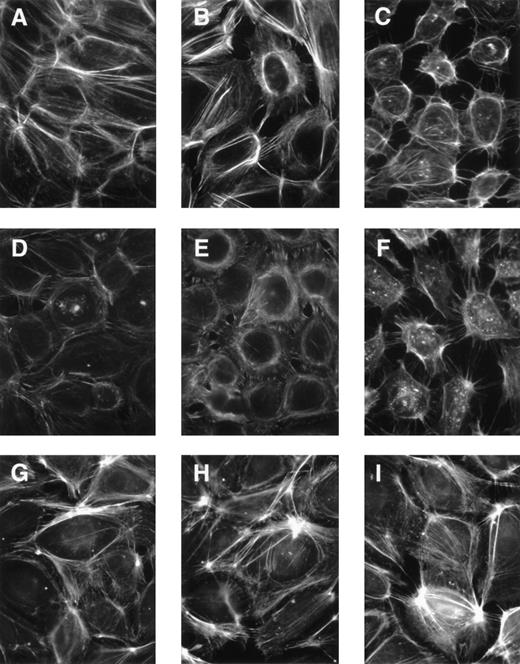 Fig. 5. Immunofluorescence microscopy (IF) shows the effect of thrombin and EDTA, and inhibitors of EC contraction on actin and ICGF. Actin was stained with rhodamine-labeled phalloidin. The camera shutter speed was set automatically so the intensities are not relative. These representative photos show that thrombin- but not EDTA-induced ICGF was blocked by the inhibitor, bromo-cAMP, and that both were blocked by the cross-linker, glutaraldehyde. HUVEC in the photos were (A) untreated; (B) thrombin-stimulated; (C) EDTA-treated; (D) incubated with bromo-cAMP before treating with control buffer; (E) incubated with bromo-cAMP before treating with thrombin; (F) incubated with bromo-cAMP before treating with EDTA; (G) incubated with glutaraldehyde before treating with control buffer; (H) incubated with glutaraldehyde before treating with thrombin; and (I) incubated with glutaraldehyde before treating with EDTA.