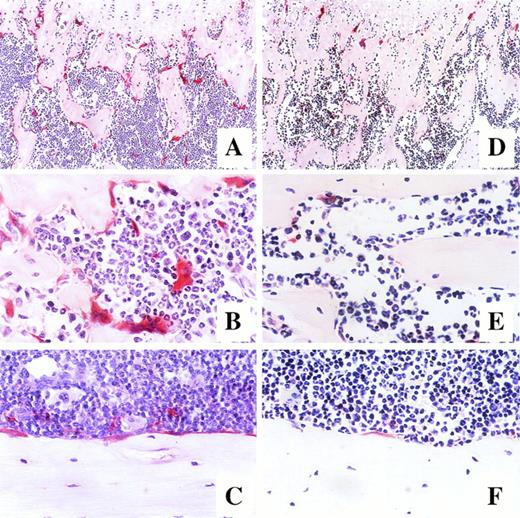 Fig. 6. Photomicrographs of longitudinal sections of femur in mice after 7-day administration of either G-CSF (A, B, and C) or saline (D, E, and F). Mice were killed on day 14 of treatment, and the histologic sections of the trabecular region of the metaphysis (A and D at original magnification × 100, B and E at original magnification × 400) and endosteum of bone shaft (C and F at original magnification × 400) were stained for tartrate-resistant acid phosphatase.