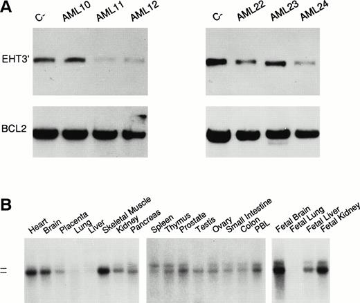 Fig. 2. (A) Analysis of EHT gene in AML cases by quantitative Southern blot: cases AML11, 12, 22, and 24 show a loss of signal with respect to the control probe (PFL-1 probe for Bcl-2 gene). Because the percentage of leukemia cells in all cases is greater than 70%, this finding is consistent with an homozygous deletion. The probe (EHT3′) was specific for the 3′ UTR of EHT. (B) EHT gene expression analysis. Poly-A+ Northern blot filters (Clontech), were hybridized with the EHT3′ probe. The two dashes indicate the molecular weight (9.5 and 7.5 kb). The two transcripts were not represented in all of the tissues at the same level; in the testis, heart, brain, and skeletal muscle, the lower transcript was particularly expressed.