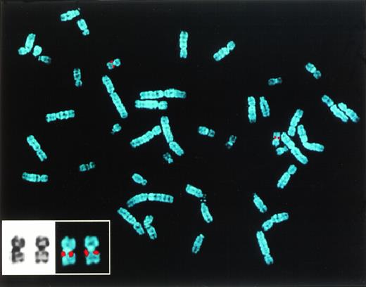 Fig. 1. (Top) Sequence comparison between the 5′ end of EHT and MTGR1 (italics) cDNAs. Translated sequences are shown in capital letters; a 27-bp nucleotide stretch upstream of the EHT ATG which is similar to the MTGR1 is underlined. The stop codons upstream of ATGs are in bold letters. (Bottom) Mapping by FISH of EHT gene on chromosome 20q11.