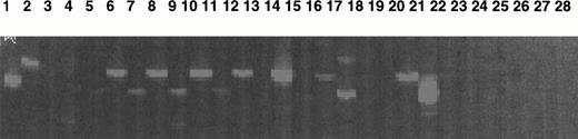 Fig. 7. Study of Mpl-L transcripts by a sensitive fluorescent RT-PCR assay. Mpl-L transcripts were amplified from total RNA of different cell types, and the amplification products were run on a sequencing gel. Size of the amplified product is 183 bp. Lane 1, HepG2 diluted 1:10; lane 2, HEL; lane 3, CD34+ cells from peripheral blood cytapheresis; lane 4, cultured MKs from a normal marrow; lane 5, spontaneously growing MKs from t10; lane 6, spontaneously growing MKs from t11; lane 7, spontaneously growing MKs from t12; lane 8, CD34+ from t16; lane 9, spontaneously growing MKs from t16; lane 10, CD34+ from t19; lane 11, spontaneously growing MKs from t19; lane 12, blood monuclear cells from m1; lane 13, CD34+ cells from m1; lane 14, spontaneously growing MKs from m1; lane 15, CD34+ from m2; lane 16, spontaneously growing MKs from m2; lane 17, CD34+ from m3; lane 18, spontaneously growing MKs from m3; lane 19, cultured MK after PEG-rhuMGDF stimulation from m3; lane 20, CD34+cells from m7; lane 21, spontaneously growing MKs from m6; lane 22, cultured MK after PEG-rhuMGDF stimulation from m6; lane 23, spontaneously growing MKs from m8; lane 24, cultured MK after PEG-rhuMGDF stimulation from m8; lane 25, CD34+ cells from m4; lane 26, spontaneously growing MKs from m4; lane 27, H2O control; lane 28, H2O control.