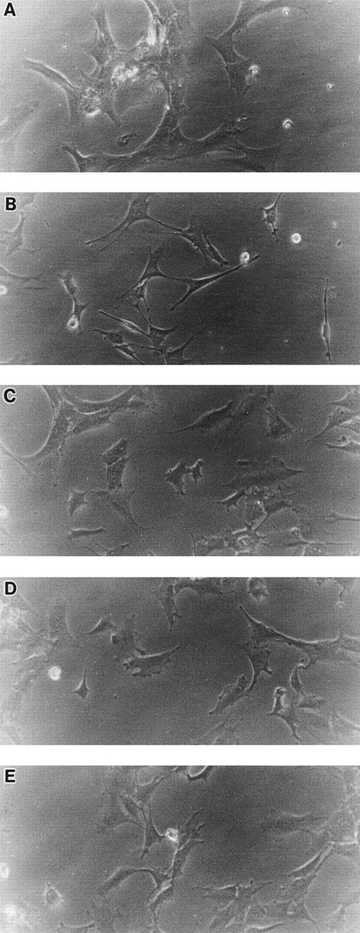 Fig. 1. Morphology of STR-2, STR-4, STR-10, STR-12, and LE1SVO cells. (A) LE1SVO; (B) STR-2; (C) STR-4; (D) STR-10; (E) STR-12 (original magnification × 400 under an inverted microscope).