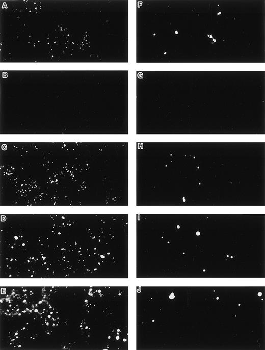 Fig. 2. Uptake of DiI-Ac-LDL and staining by anti–factor VIII antibody. (A and F) LE1SVO; (B and G) STR-2; (C and H) STR-4; (D and I) STR-10; (E and J) STR-12. (A through E) The cells were incubated with anti–factor VIII antibody and fluorescein-conjugated second antibody, and then examined under a confocal laser microscope (original magnification × 100). (F through J) The cells were incubated with DiI-acetylated LDL (10 mg/mL) at 37°C for 4 hours. After thorough washing, the cells were fixed and then evaluated for LDL uptake under a confocal laser microscope (original magnification × 100).