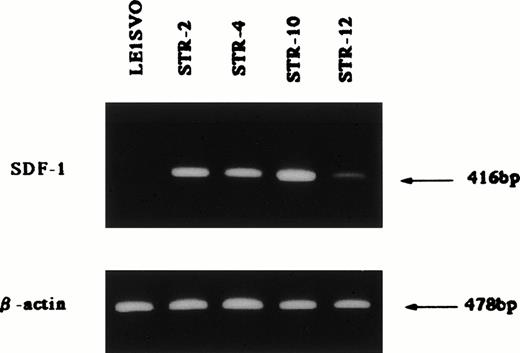 Fig. 5. Expression of SDF-1 β-actin; 25 cycles amplified, SDF-1; 35 cycles amplified.
