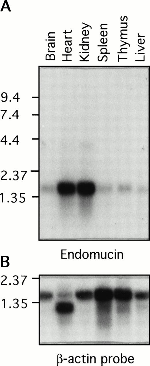 Fig. 7. Distribution of the endomucin RNA expression. Northern blot analysis of endomucin. Northern blot containing RNA from various mouse tissues (as indicated) with 2 μg Poly(A)+ RNA per lane was hybridized with the 32P-labeled endomucin cDNA probe (A) or a probe for β-actin (B) as a control. Positions of size markers (in kilobases) are shown on the left.
