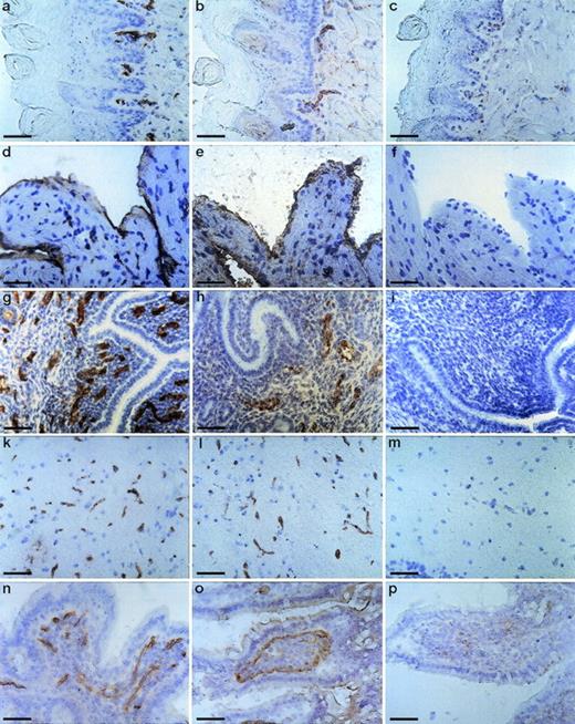 Fig. 2. Staining of cryostat sections of mouse tissues with the MoAb V.5C7. Cryostat sections of tongue (a, b, and c), heart (d, e, and f), uterus (g, h, and i), brain (k, l, and m), and small intestine (n, o, and p) were reacted with the MoAb V.5C7 (a, d, g, k, and n), polyclonal rabbit antibodies against von Willebrand factor (e, h, and o), the rat MoAb 9EG7 against integrin chain β1 (l), the rat MoAb EA3 against mouse PECAM-1 (b), or no first antibody (c, f, i, m, and p). First antibodies were detected by an immunoperoxidase technique. The bar represents 50 μm.