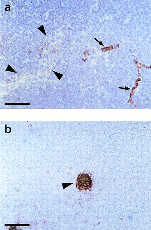 Fig. 4. Endomucin is not expressed on HEV of lymphatic tissue. Cryostat sections of mesenteric lymph nodes were incubated with MoAb V.5C7 (a) (endomucin) or MoAb MECA 367 (b) against the vascular addressin MAdCAM-1 (MAdCAM-1). Arrowheads point to HEV and arrows point to capillaries. The bar represents 50 μm.