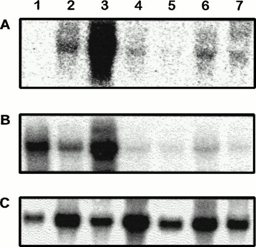 Fig. 3. Northern blot analysis of CAT, VE-cadherin, and GAPDH mRNA in adult transgenic tissues. RNA from wild-type lung (1) and transgenic heart (2), lung (3), brain (4), liver (5), kidney (6), and thymus (7) were hybridized to CAT (A), VE-cadherin (B), and GAPDH (C) probes. Similar expression profiles could be observed between CAT and VE-cadherin in transgenic tissues.
