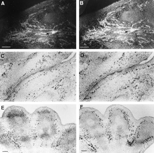 Fig. 4. Comparison of transgene and VE-cadherinexpression. Costaining of a E13.5 embryo section with anti-CAT (A) and anti–VE-cadherin (B) antibodies showed an identical expression pattern, as illustrated here for the oral area. In situ hybridizations, performed with either the CAT (C,E) or the VE-cadherin(D,F) probe on adjacent sections (10 μm), confirmed specific endothelial expression of CAT at the transcript level. (C,D) Oral area; (E,F) hindlimb; scale bars represent 100 μm.
