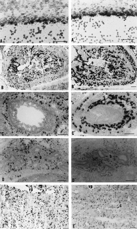 Fig. 7. Endothelial expression of the CAT gene in various tissues of E13.5 embryos. Embryo sections were hybridized withCAT (A-E) or VE-cadherin (A′-E′) antisense transcripts. Comparison of gene expression in aorta (A-A′), heart (B-B′), intestine (C-C′), lung (D-D′), and liver (E-E′). Scale bars represent 50 μm (A-A′) or 100 μm (B-E, B′-E′); b, bronchi; c, capillary; e, endocardium; my, myocardium; ve, ventricle; vp, venous plexus.
