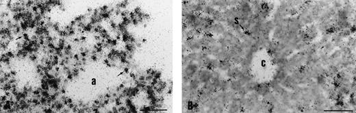 Fig. 8. Endothelial expression of the transgene in adult organs. In the lung (A), silver grains are located over endothelial cells of capillaries (arrows) interspersed between pneumocytes. CATexpression in the sinusoids and centrilobular vein of the liver (B). Scale bar is 45 μm; a, alveolae; c, centrilobular vein; s, sinusoids.