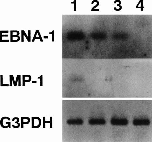 Fig. 5. Detection of mRNA for EBNA-1 and LMP-1. The expression of EBNA-1, LMP-1, and G3PDH mRNA was examined by RT-PCR. Lane 1, Raji cells; lane 2, HB4C5 cells; lane 3, HTD8 cells; and lane 4, Molt-4 cells. The PCR-amplified products were run on agarose gels and assayed for hybridization to specific internal probes (EBNA-1 probe: 5′-TGACGGAGATGAAGGAGGTG-3′; LMP-1 probe: 5′-TTGTGCTGTTCATCTTTGGC-3′) by Southern blotting.