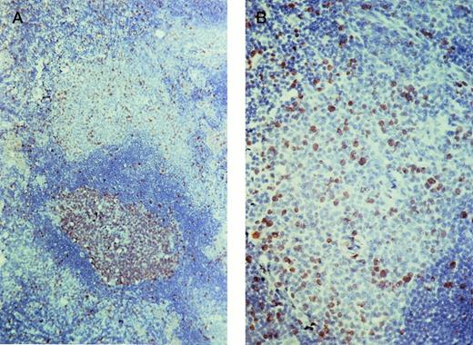 Fig. 3. Ki67 staining of a lymph node. (A) The germinal center of the secondary follicle (bottom) contains numerous Ki67-expressing cells. A smaller but impressive number of Ki67-expressing cells are also observed in the marginal zone (top). (B) Detail of the marginal zone.