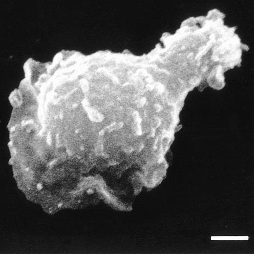 Fig. 3. SEM of a 5T2 MM cell with a polarized morphology, typical for locomotory activity. Bar = 2 μm.