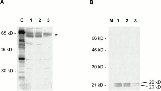 Fig. 2. (A) Expression of c-Myc in CTCL cell lines studied by Western blotting with a polyclonal c-Myc antiserum (Santa Cruz Biotechnology). C, positive control with a 65-kD recombinant c-Myc–Glutathione-S-transferase (GST) fusion protein (Santa Cruz Biotechnology). Lanes 1 to 3, nuclear extracts from HUT78 (lane 1), MyLa (lane 2), and SeAx (lane 3) cells. The expected position of the differently modified c-Myc proteins (approximately 60 to 65 kD) is indicated on the right by an asterisk. The different bands in the area may result from differently phosphorylated forms of c-Myc. (B) Expression of Max in CTCL cell lines tested by a polyclonal Max antibody (Santa Cruz Biotechnology). M, marker; lanes 1 to 3, nuclear extracts from HUT78 (lane 1), MyLa (lane 2), and SeAx (lane 3) cells. The positions of the two forms of the Max protein are indicated on the right.