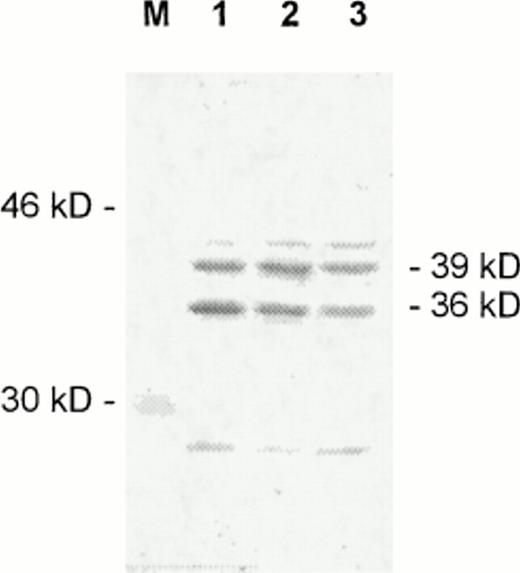 Fig. 4. Expression of JunD in CTCL cell lines studied by Western blotting with a polyclonal JunD antiserum (Santa Cruz Biotechnology). M, marker; lanes 1 to 3, nuclear extracts from HUT78 (lane 1), MyLa (lane 2), and SeAx (lane 3) cells. The positions of the two forms of JunD (39 kD and 36 kD) are indicated on the right.