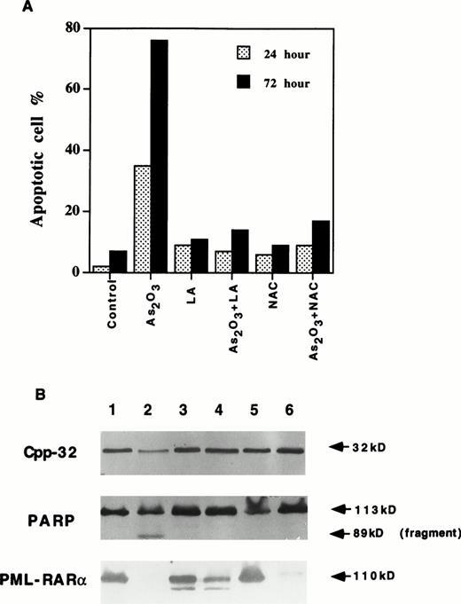 Fig. 2. (A) NAC and lipoic acid (LA) blocked As2O3-induced apoptosis but not PML/RAR- degradation in NB4 cells. NB4 cells were treated with 2 μmol/L As2O3 alone or together with 10 mmol/L NAC or 100 μmol/L LA for 24 and 72 hours. Apoptotic cells were determined by fluorescence staining as described in Materials and Methods. Values are the mean of three independent experiments. (B) NAC and LA blocked As2O3-induced activation of Cpp32 and cleavage of PARP, but not PML/RAR- degradation in NB4 cells. Lane 1, control; lane 2, As2O3; lane 3, LA; lane 4, As2O3 + LA; lane 5, NAC; lane 6, As2O3 + NAC. Cells were treated with concentrations described above for 24 hours.
