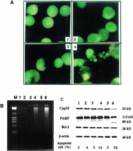 Fig. 5. As2O3 combined with AA induces apoptosis in su-DHL-4 cells. (A) Morphologic features of apoptosis. Cells were treated for 24 hours. 1, Without treatment; 2, As2O3 (1 μmol/L); 3, AA (62.5 μmol/L); 4, As2O3 (1 μmol/L) with AA (62.5 μmol/L). Apoptotic cells were determined with fluorescence staining as described in Materials and Methods. (B) DNA fragmentation. Cells were treated for 24 hours and total DNA was isolated and separated on agarose gel. DNA ladder was visualized with EB as described in Materials and Methods. Lane M, size markers, λ DNA HindIII digest and φx174 RF DNAHaeII digest; lane 1, control; lane 2, As2O3 (1 μmol/L); lane 3, AA (62.5 μmol/L); lane 4, As2O3 (1 μmol/L) + AA (62.5 μmol/L); lane 5, AA (125 μmol/L); lane 6, As2O3 (1 μmol/L) + AA (125 μmol/L). (C) Activation of CPP32 and effect on Bcl-2 by treatments as in B.