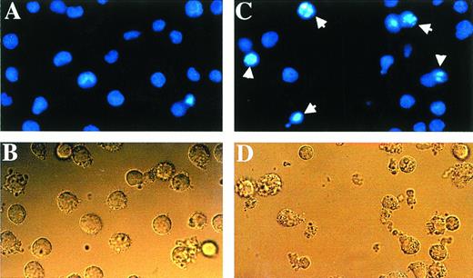 Fig. 2. The combination of As and IFN induced morphologic changes characteristic of apoptosis when stained with Hoescht 33342. The nuclei of HUT-102 cells treated with the combination of As and IFN (C) underwent apoptosis, as shown by their characteristically shrunken and intensely-fluorescent nuclei (arrowheads). Control cells (A) displayed the typical morphology of nuclei, as did HUT-102 cells treated with As only (data not shown). Under light microscopy, cells treated with the combination of As and IFN (D) were less numerous and exhibited membrane blebbing when compared with control cells (B).