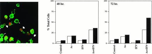 Fig. 4. Annexin-V binding: HUT-102 cells were treated for 48 hours or 72 hours with As (1 mmol/L), IFN (1,000 U/mL), or their combination. Using FITC-conjugated Annexin-V membrane staining and PI nuclear counterstaining, the relative amount of apoptotic cells (FITC+ PI−) and dead cells either necrotic or postapoptotic (FITC+ PI+) was determined. The percentage of dead cells is relative to the total cell population, while the percentage of apoptotic cells is presented with regard to the PI−, ie, nondead cells. (□), Apoptotic; (▪), dead. Fluorescence microscopy analysis showed the presence of apoptotic cells (small arrows) and dead cells (large arrows).