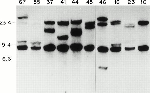 Fig. 1. ETV6 gene rearrangements in patient samples. Southern blot of BamHI-digested genomic DNA hybridized to the 0.9-kb ETV6 cDNA probe. Size standards are in kb. The unique patient numbers are indicated above each lane. Lane 10 contains DNA from a leukemic patient without an ETV6 gene rearrangement. Twenty-kb and 7-kb bands represent germline ETV6 fragments; rearranged fragments representing ETV6 translocations can be identified in all samples except no. 10.