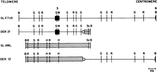 Fig. 4. Restriction map of germline ETV6 (GL ETV6), germline AML1 (GL AML), and the derivative 12 (DER 12) and derivative 21 (DER 21) alleles from patient 41. ETV6 exons are shown as solid boxes (▪). ETV6 is depicted as a straight line; AML1 is crosshatched (▧). The open boxed area (□) depicted at the breakpoint junction in the two derivative alleles represents a deletion of 540 bp of the ETV6 gene and 165 bp of the AML1 gene observed in this patient. Restriction enzyme sites are B, BamHI; G, BglII; R, EcoRI; S,SstI; M, MluI; H, HindIII; and Sc, ScaI .