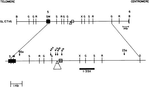 Fig. 5. Map of the ETV6 gene between exon 5 and 6 containing the ETV6 breakpoint cluster region (bcr). Chromosomal orientation from telomere to centromere is as indicated. Exons 5 and 6 are shown as solid boxes. The breakpoints in the different patients are shown as downward arrows with the patient identification numbers marked above. Patients 41 and 44 have two breakpoints each, designated 41a and 41b, and 44a and 44b, respectively. The portion of the gene between these breakpoints is deleted in each patient. Only the derivative 21 was cloned from patients 23 and 55. The 0.3-kb area in the ETV6 gene, shown as a speckled box, represents a pu/py repeat region. The 0.7-kb region depicted by the triangle is a deletion/insertion polymorphism in theETV6 gene. Restriction enzyme sites are B,BamHI; G, BglII; R, EcoRI; S, SstI; M, MluI; H,HindIII and X, XbaI. The 1.3-kbSstI-XbaI probe used to identify the deletion/insertion polymorphism on Southern blot is indicated .