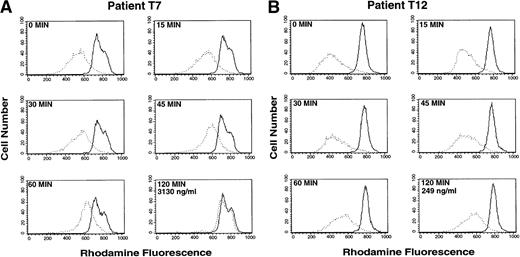 Fig. 3. Inhibition of rhodamine efflux from CD56+cells after initial exposure to PSC 833. Whole blood was obtained 0, 15, 30, 45, 60, and 120 minutes after an initial dose of PSC 833. Rhodamine 123 was added to whole blood and incubated for 30 minutes and the mononuclear cells were separated and incubated for an additional 60 minutes in rhodamine-free media before staining with PE-labeled CD56 antibody to generate the Efflux histogram (dotted line), or rhodamine 123 and PSC 833 were both added to the blood during the 30-minute incubation period and the mononuclear cells were separated and incubated in rhodamine-free media with PSC 833 before PE-labeled CD56 staining to yield the PSC/Efflux histogram (solid line). A small difference between the Efflux and PSC/Efflux peak signifies greater blocking of Pgp by PSC 833 in patient blood; a larger difference indicates poor reversal. (A) Patient T7 shows near complete reversal of Pgp-mediated rhodamine efflux in CD56+ cells. Reversal can be seen 45 minutes after a single oral dose of PSC 833. (B) Patient T12 shows incomplete reversal of Pgp in CD56+ cells. Virtually no effect is seen 2 hours after administration of PSC 833. The two patients shown received identical doses of PSC 833. The PSC 833 levels in the two patients after two hours are 3130 ng/mL (T7) and 249 ng/mL (T12).