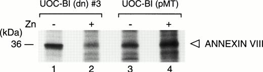 Fig. 3. Regulation of ANNEXIN VIII protein synthesis. UOC-B1(dn)3 (lanes 1 and 2) or control UOC-B1(pMT) (lanes 3 and 4) cells were grown without exogenous zinc (lanes 1 and 3) or for 24 hours in the presence of zinc (100 μmol/L; lanes 2 and 4). Metabolically labeled lysates of these cells were immunoprecipitated with an ANNEXIN VIII antiserum.