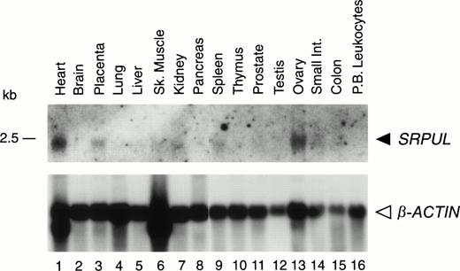 Fig. 6. Expression of SRPUL mRNA in normal tissues. Northern blot analysis of poly(A) RNA (2 μg per lane) isolated from various human tissues, hybridized with a SRPUL cDNA probe, and then stripped and rehybridized with a β-ACTIN probe. The mobility of a 2.5-kb RNA marker is indicated.