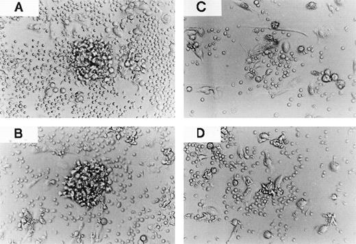 Fig. 5. CCR-1 and CCR-3 are involved in clustering of monocyte-derived DCs with TCs. TCs purified from PBMCs (105) were cultured with monocyte-derived DCs (104) in the absence (A) or presence of 10 μg/mL cont. IgG (B), anti–CCR-1 MoAb (C), or anti–CCR-3 MoAb (D). The coculture of monocyte-derived DCs with TCs was measured on day 5. Original magnification × 200. The results are representative of two experiments performed with similar results.