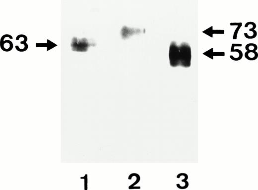 Fig. 3. Immunoprecipitation of allele-specific FcγRIIIb recombinant isoforms from biotin surface-labeled CHO stable transfectants expressing SH (lane 1), NA2 (lane 2), and NA1 (lane 3) granulocyte antigens. After solubilization CHO lysates were immunoprecipitated with MoAb 3G8 specific for FcγRIIIb. Immunoprecipitates were separated on 7.5% SDS-PAGE under nonreducing conditions and were transferred by immunoblotting. Biotin-labeled proteins were visualized using streptavidin and chemiluminescence substrate system. Note the different electrophorectic migrations of the various FcγRIIIb isoforms.
