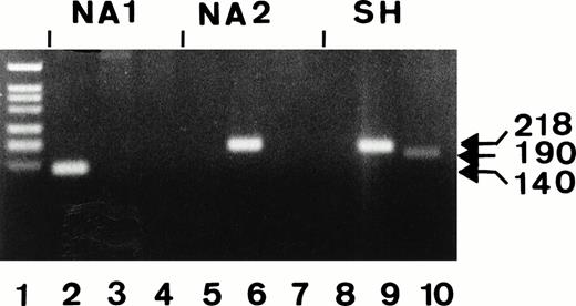 Fig. 5. Genotyping analysis of the stable CHO transfectants expressing NA1-, NA2-, and SH-isoforms by allele-specific PCR. DNA were isolated from the transfectants and were amplified using allele-specific NA1- (lanes 2, 5, and 8), NA2-(lanes 3, 6, and 9), and SH- (lanes 4, 7, and 10) primer. PCR products were analyzed on 1.5% agarose gel using MW VI (lane 1; Boehringer Mannheim, Mannheim, Germany) as molecular weight standards.