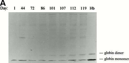Fig. 2. Western blot analysis of globin deposition on the membranes of in vivo–aged biotinylated dog RBCs. Positive (biotinylated) RBCs were isolated from dog no. 5005 at the indicated times post-biotinylation by magnetic cell sorting. (A) Ghost membranes were prepared as described in the Materials and Methods. At the end of the study, membranes (20 μg) were electrophoresed, transferred to nitrocellulose, and analyzed for globin by immunoblotting as described in Materials and Methods. The lane marked Hb contains 5 μg of soluble Hb obtained from a dog RBC lysate. (B) Results of scanning densitometry of the dimeric globin band seen in the immunoblot in (A). The integrated area of the globin dimer band is plotted as a function of the minimum age of the biotinylated cells. A similar increase in membrane-bound globin appeared on the membranes of cells isolated from dog no. 1630 (data not shown).