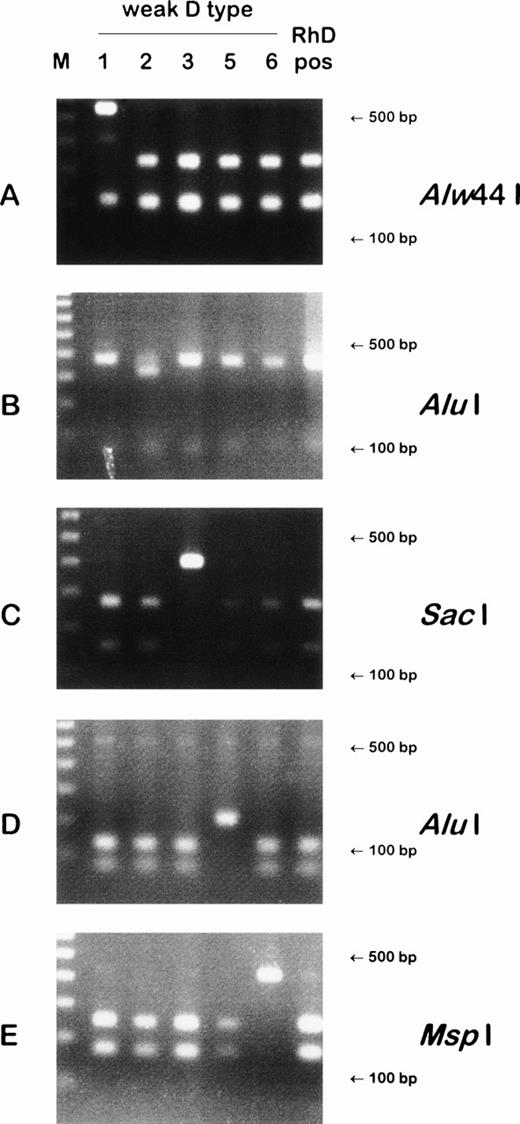 Fig. 1. Detection of weak D types by PCR-RFLP. Four weak D types harbored point mutations that obliterated restriction sites: weak D type 1 lacks an Alw44 I site (A); weak D type 3, a SacI site (C); weak D type 5, an Alu I site (D); and weak D type 6, a Msp I site (E). In a fifth weak D type, a point mutation introduced a restriction site: weak D type 2 gained an Alu I site (B). On the left side of the gels, 100 bp ladders are shown; the position of the 500 bp and 100 bp fragments are indicated on the right side of the panels. For the PCR reaction of (A), the largest restriction fragment approximation 3,000 bp is not shown.