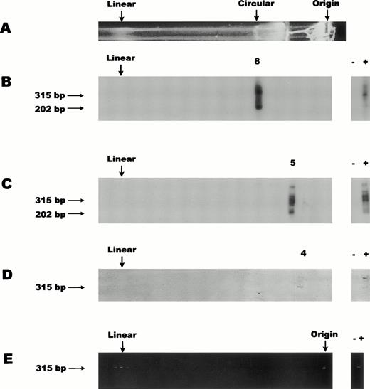 Fig. 2. CMV genome conformation in PB CD14+ cells. For all panels the top (Origin) of the gel is represented on the right and the bottom of the gel is depicted on the left. Symbols + and − indicate positive and negative controls for PCR. Numbers 8, 5, and 4 label the probe-positive cores for panels (B), (C), and (D), respectively. Size markers (315 bp and 202 bp) for the primary and nested PCR products, respectively, are represented. (A) Ethidium bromide–stained gel showing a representative lane containing 108 cells of S flexneri bacteria carrying the ≈230-kb circular megaplasmid marker. Ethidium bromide staining of bacterial chromosomal DNA is associated with the region near the well origin (Origin). The lower edge of the proteinase K/SDS/agarose trough is seen as a brightly stained region midway between the circular marker and the well origin. The circular megaplasmid control migrated at core 8 for all gels shown in panels (B), (C), (D), and (E). The apparent linear megaplasmid band (Linear) invariably comigrated with the CMV linear band as exemplified in the positive cores after PCR amplification of low copy CMV-infected cells (E). (B) DNA blot analysis of nested PCR products, from an inclusive series of sequential agarose cores collected from the gel lane prepared from set 1 of pooled CD14+ cells from five donors. (C) DNA blot analysis similar to (B), from set 2 (3 donors). (D) DNA blot analysis of primary PCR products, from set 3 (5 donors) and using only 10% of the proteinase K normally used in block preparation. (E) Ethidium bromide–stained gel of PCR amplification of low copy CMV-infected cells.