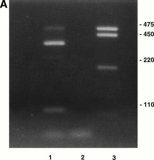 Fig. 1. (A) RT-PCR amplification of marrow stromal RNA using primers complementary to sequences on each side of the alternatively spliced IIICS region of fibronectin. Ten microliters of PCR products was run out on a TBE/2% agarose gel. Lane 1, reaction with RT; lane 2, control without reverse transcriptase; lane 3, DNA marker. The four bands in lane 1 are consistent with variants V120 (464 bp), V95 or 89 (389 or 371 bp), V64 (296 bp), and V0 (104 bp). (B) Restriction enzyme digests of selected clones prepared from TA cloning RT-PCR products of IIICS region of fibronectin. Three microliters of digested products was run on a TBE/1% agarose gel.BglII cuts the IIICS region when the CS1 sequence is present. A second BglII site in the pCRTM II vector results in 1,155- and 3,148-bp products in the presence of a CS1/IIICS-B insert (V89) as shown in lanes 2 and 4. The band in lane 3 is consistent with a IIICS-B insert (V64) within the linearized vector (4,124 bp).