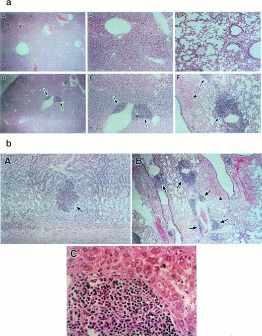 Fig. 4. (a and b) Histopathology from bm1 mice after transfer of C57BL/6 or MIP-1−/− B6 splenocytes. Bm1 mice that received splenocytes from C57BL/6 or MIP-1−/− B6 were killed 150 days after transfer. Tissues were prepared as indicated in the text. (a) shows (A and B) sections of liver from bm1 mouse that received MIP-1−/− B6 splenocytes compared with sections from an animal that received C57BL/6 splenocytes (D and E). Sections (A and B) and (D and E) represent two different magnifications of the same liver zone. (a, C) is a section of the lung of a bm1 mouse that received MIP-1−/− B6 splenocytes compared with (F) and (b, B) sections of lung from a bm1 mouse that received C57BL/6 splenocytes (figures are of the same section at different magnifications). Foci of inflammation are indicated by the arrows. The arrowheads indicate extravasation of material into the lungs of bm1 mice that received C57BL/6 splenocytes. (b, A) shows a crypt abscess in the gastrointestinal tract of a bm1 animal that received C57BL/6 splenocytes; these were not seen in animals that received MIP-1−/− splenocytes. The character of the mononuclear cell infiltrate in the liver is shown in (b, C).
