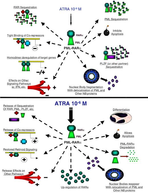 Fig. 5. Suggested model of PML-RAR action in APL. (A) At 10−9 to 10−8 mol/L ATRA, PML-RAR prevents activation of key target genes required for myeloid differentiation by sequestration of RXR and other RAR cofactors, inhibiting normal RAR function. In addition, PML-RAR may bind to RAR targets as a homodimer or as a heterodimer with RXR and inhibit transcription of these genes by recruitment of corepressor/histone deacetlyase complexes. PML-RAR also may affect transcription mediated by AP1 and IFN-responsive factors and can sequester PLZF and potentially affect its function. PML-RAR prevents apoptosis through unknown mechanisms and delocalizes PML and other proteins from the nuclear body, although the importance of this is uncertain, because the NB is normal in the other forms of APL. (B) In the presence of pharmacological doses of ATRA, the PML-RAR fusion is degraded and releases PML and other cofactors. The NB structure is restored. A residual fragment of the PML-RAR fusion and/or the wild-type RAR, which is upregulated in response to ATRA, can then stimulate transcription of myeloid target genes. The blockade of other signaling pathways is released and the anti-apoptotic effect of PML-RAR is lost. As a result, terminal cell differentiation can proceed.