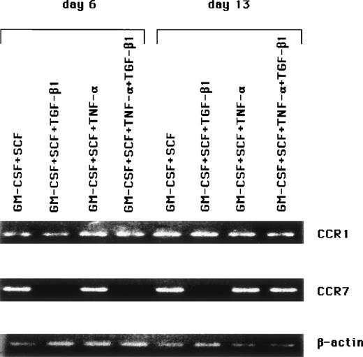 Fig. 5. The regulation of CCR7 expression on combined cytokine-stimulated HPCs by TGF-β1.