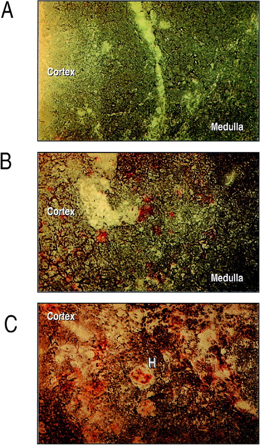 Fig. 1. Immunohistochemical analysis of eotaxin expression in human neonatal thymus. Human neonatal thymus (1 week) was sectioned and prepared for eotaxin staining as detailed in Materials and Methods. (A) Negative control. (B and C) Staining of eotaxin around cells with dendritic morphology and in Hassle’s corpuscles, respectively. Results are representative of n = 3 separate donors.