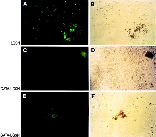 Fig. 6. Expression of EGFP in G418-resistant colonies grown in methylcellulose from CD34+ hematopoietic progenitors transduced with LGSN (A and B) and GATA-LGSN (C through F) vectors. Green-fluorescence and bright-field views of the same fields are shown in the left and right panels, respectively.