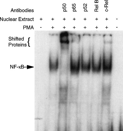 Fig. 1. PMA induces NF-κB specific DNA-binding in human CD34+CD19− bone marrow cells. To confirm specificity and identify which Rel family members may be binding to the NF-κB consensus sequence, super-shift EMSA were performed with antibodies specific for human p50, p65, p52, rel B, and c-rel. The CD34+CD19− cells were 96.8% pure for this representative experiment.