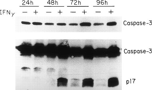 Fig. 5. Upregulation and delayed activation of caspase-3/CPP32/apopain in human ECFC after incubation with IFNγ. Day-6 cells were cultured in liquid medium or medium containing 500 U/mL of IFNγ for 24 to 96 hours and the cell proteins were analyzed by immunoblotting in three separate experiments. The top panel shows intact caspase-3 expression using MoAb that only reacts with the proenzyme. A polyclonal antibody reacting to both the intact enzyme and its fragments was used in the bottom panel. The proenzyme is significantly increased and a clear cleavage of caspase-3 occurs by 48 hours after incubation with IFNγ.