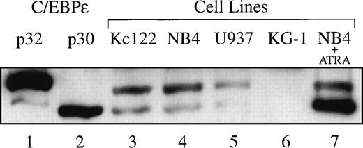Fig. 1. Western blot demonstrating the expression of p32 and p30 isoforms of C/EBPɛ in myeloid cell lines: Kcl22 myeloblasts (lane 3), NB4 promyelocytes (lane 4), and U937 myelomonoblasts (lane 5). The isoforms p32 and p30 were expressed at a ratio of approximately 2:1. NB4 cells treated with 10−6 mol/L ATRA for 24 hours selectively upregulate C/EBPɛ p30 (lane 7). The KG-1 early myeloblasts did not express detectable C/EBPɛ levels (lane 6). C/EBPɛ p32 (lane 1) and p30 (lane 2) cDNAs transfected and expressed in COS-1 cells were run alongside as positive controls.