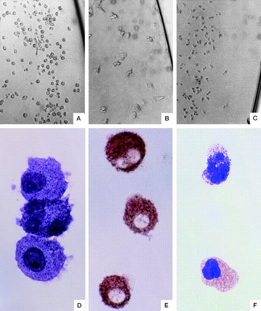 Fig. 2. Morphology of single-cell–derived colonies. A typical mast cell colony grown in the presence of SF + IL-6 (A). A typical macrophage colony (B) and a typical basophil colony (C) grown in the presence of IL-3. The colony (A)-derived mast cells stained with May-Giemsa (D) or antitryptase immunostaining (E). May-Giemsa staining of a basophil (top) and an eosinophil (bottom) found in a mixed basophil-eosinophil colony (F). Original magnification: ×183 (A, B, and C), ×1100 (D and F), and ×733 (E).