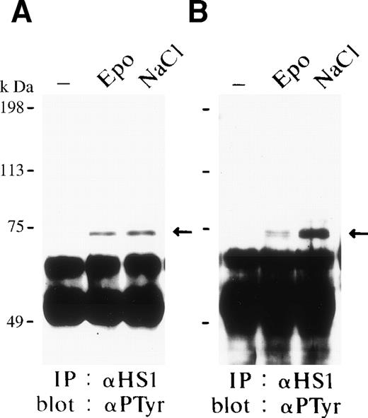 Fig. 4. HS1 is tyrosine-phosphorylated in response to Epo and osmotic shock. The same filters shown in Fig 3 were reprobed with the antiphosphotyrosine antibody 4G10. The arrow indicates the tyrosine-phosphorylated HS1.