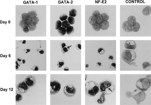 Fig. 4. Expression of transcription factors GATA-1, GATA-2, and p45 NF-E2 in CB CD34+Lin− cells induced to unilineage erythroid differentiation. Transcription factor expression was evaluated by immunohistochemistry (immunogold staining with silverenhancement method) using specific MoAbs (original magnification × 400 and × 1,000). Arrows indicate nuclear staining of selected cells. Control staining was performed with irrelevant, isotype-matched rat or mouse MoAbs as well as with irrelevant rabit antibody.