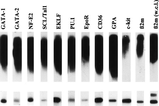 Fig. 8. Nonquantitative, sequence-independent RT-PCR (SIP-RT-PCR) of single daughter cells induced to unilineage erythroid differentiation. A representative experiment is shown. (Upper panel) The mRNA isolated from a single round III cell was processed for SIP-RT-PCR or SIP-RT-PCR was performed on whole cell lysate (w.c.l.; upper panel right lane). PCR products were then hybridized with32P-labeled probes (upper panel). Autoradiographs are shown. (Lower panel) Autoradiographs of corresponding sequence-specific PCR products from SIP-RT-PCR products shown in the upper panel. SIP-RT-PCR product (2.5 μL) was reamplified by PCR using sequence-specific pairs of primers (SSP-RT-PCR) recognizing the respective target gene. Note that the whole cell lysate (w.c.l.) SIP-RT-PCR results in coamplification of genomic DNA (outermost right lane) by using intron-spanning primers for β-microglobulin. No PCR products corresponding to genomic β2-microglobulin DNA sequences were detected when SIP-RT-PCR product from mRNA was reamplified by the same β2-microglobulin specific primers (lower panel, second lane from the right).