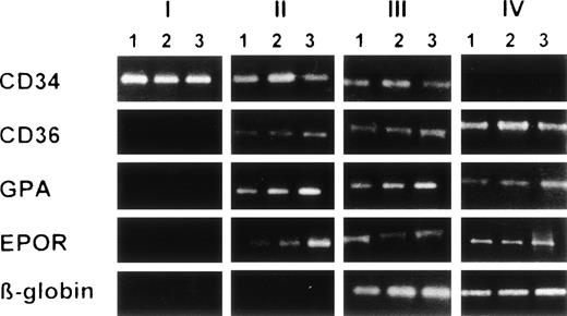 Fig. 9. Heterogeneity analysis by SSP-RT-PCR in cdc unicellular erythroid cultures of CD34+Lin− cells. At each culture round, 3 cells were processed separately for RT-PCR as described in Materials and Methods and 1 cell was transferred to the next culture round, and so forth. Note the absence of heterogeneity of individual cells from each culture round. An ethidium bromide-stained gel is shown.